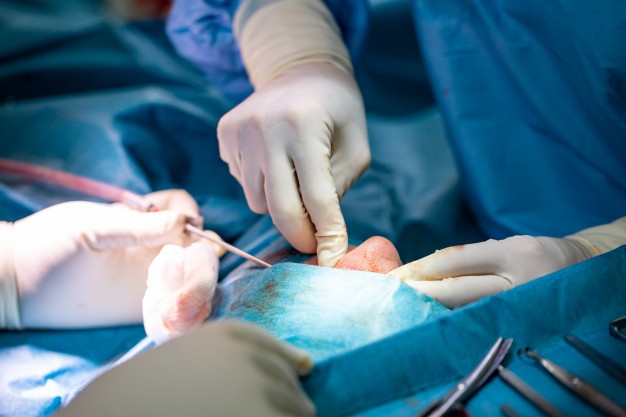 آموزش در این جراحی ها یک تفاوت جراحی زیبایی و جراحی پلاستیک محسوب می شود